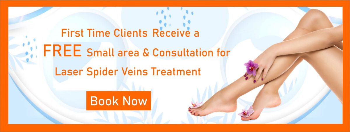 Spider Veins: Treatments & What Causes Them – Lazer Lounge Med Spa & Laser  Clinic